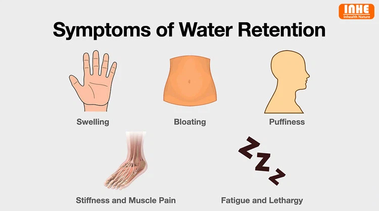 Symptoms of Water Retention